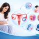 Ovarian cyst causes and symptoms